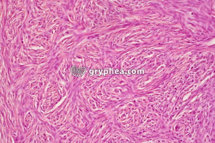 Ovaire humain stroma dépourvu de follicules x100 - gryphea.com